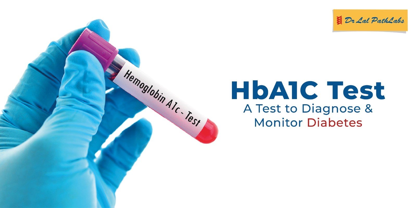 hba1c test